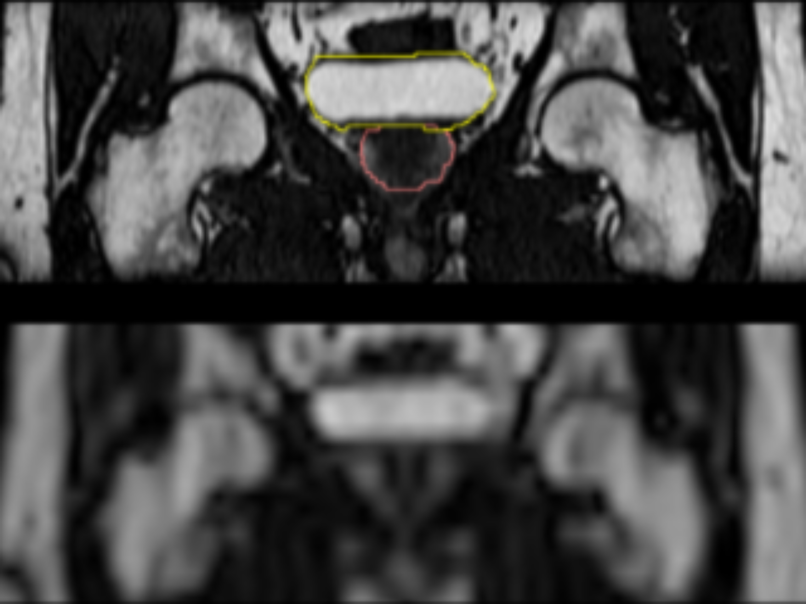 Figure 3. Example coronal images of different resolution levels and delineations.
