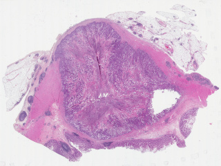 Figure 3. Overview of primary tumor whole slide imaging with hematoxylin and eosin staining.