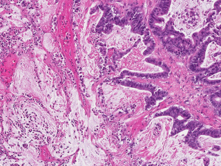 Figure 4. To-scale view of pixel resolution in original primary tumor whole slide imaging data from hematoxylin and eosin staining.