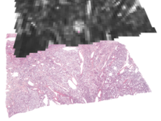 Figure 1. Diffusion MRI images were coregistered to histology slides.