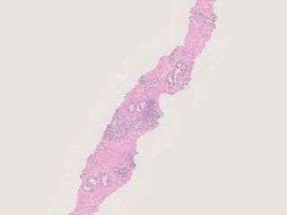 Figure 1. Example biopsy downsampled 8x